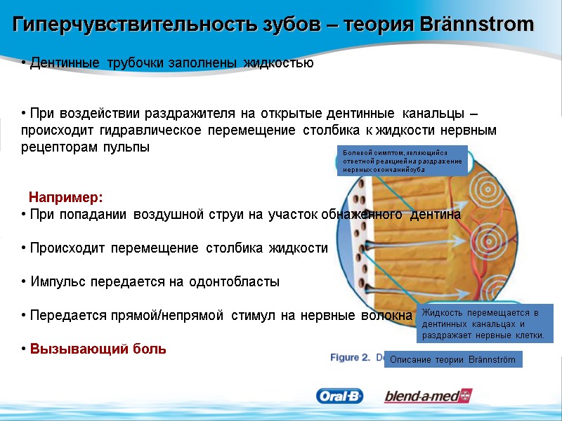 Гиперчувствительность зубов – теория Brännstrom  Дентинные трубочки заполнены жидкостью    При
